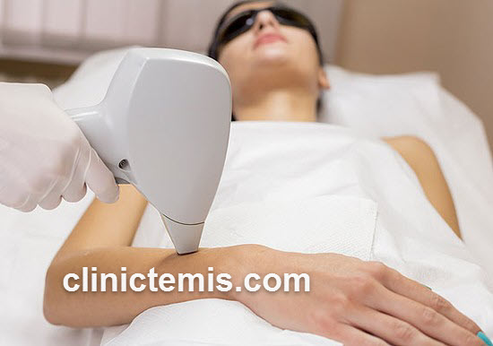بررسی مزایای لیزر موی زائد در کلینیک معتبر | کلینیک تمیس