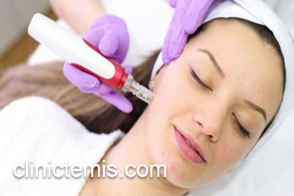 پزشک متخصص میکرونیدلینگ صورت در نازی اباد | کلینیک تمیس