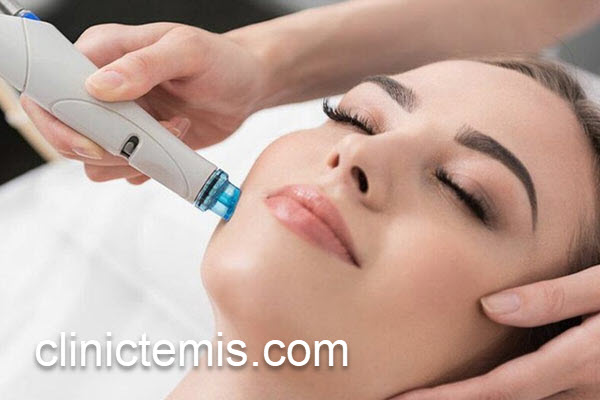 انجام میکرونیدلینگ صورت توسط پزشکان متخصص | کلینیک تمیس