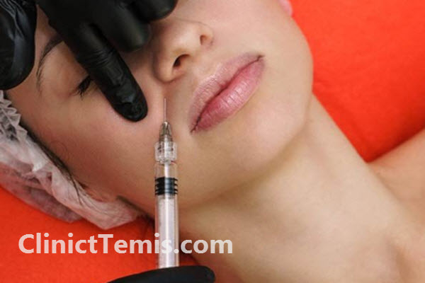 مزایای تزریق فیلر برای رفع خط خنده