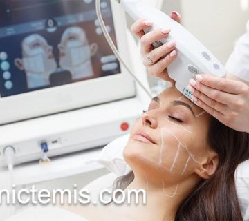 انجام هایفوتراپی صورت با ماندگاری بالا | کلینیک تمیس