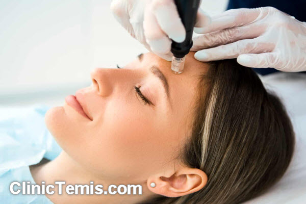دیگر روش های مراقبتی بعد از میکرونیدلینگ | کلینیک زیبایی تمیس