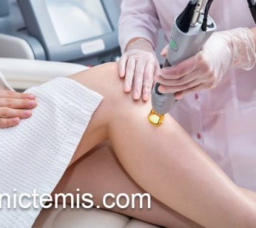لیزر موهای زائد کرکی در کلینیک تخصصی | کلینیک تمیس
