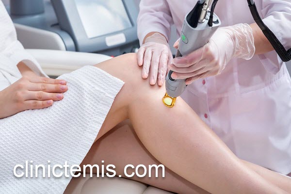 لیزر موهای زائد کرکی در کلینیک تخصصی | کلینیک تمیس