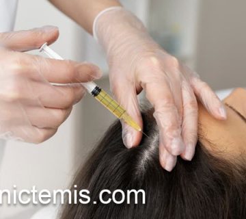 تزریق مزوتراپی مو در 10 جلسه | کلینیک تمیس