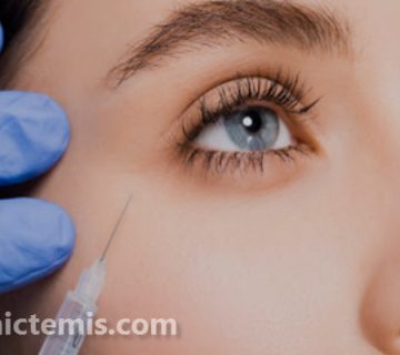 بهترین دکتر تزریق فیلر زیر چشم در نازی آباد