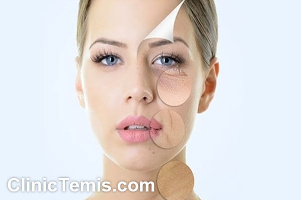 مزایای روش اندولیفت | کلینیک تمیس