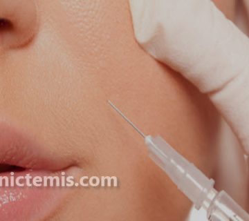 مراقبت های بعد از تزریق ژل خط خنده