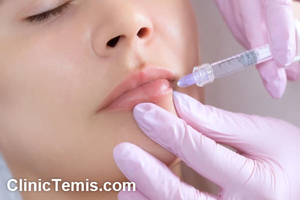 راه های افزایش ماندگاری ژل لب | کلینیک تمیس