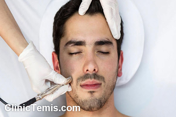 مزایای رو میکرونیدلینگ | کلینیک تمیس