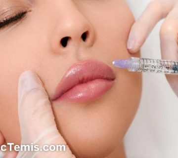 تزریق ژل خط خنده بعد از چند روز اثر می کند؟ | کلینیک تمیس