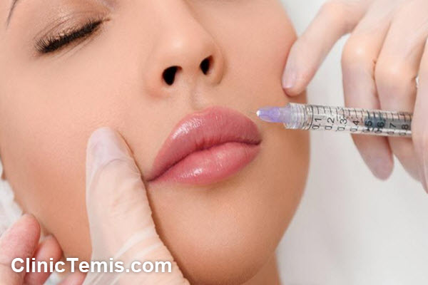تزریق ژل خط خنده بعد از چند روز اثر می کند؟ | کلینیک تمیس