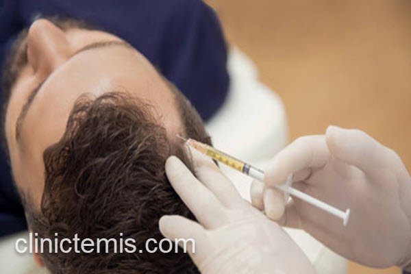انجام مزوتراپی مو در کلینیک معتبر | کلینیک تمیس