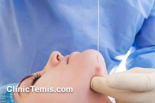 اندولیفت چیست و چگونه عمل میکند؟