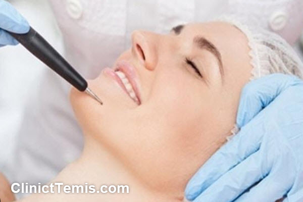ویژگی های بهترین مرکز خالبرداری با لیزر در جنوب تهران