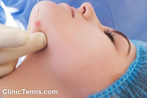 کاربردهای اندولیفت