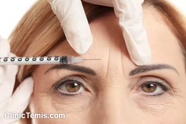 ماندگاری بوتاکس پیشانی چقدر است؟