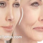 بهترین دکتر تزریق ژل خط خنده در نازی آباد
