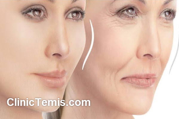 بهترین دکتر تزریق ژل خط خنده در نازی آباد