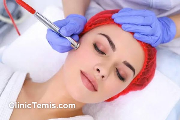 بهترین مرکز میکرودرم ابریژن در جنوب تهران