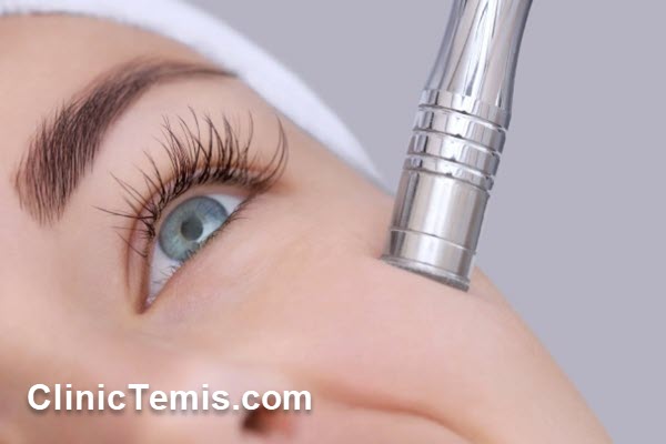 میکرودرم ابریژن چیست؟ | کلینیک تمیس