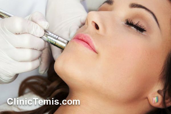 چگونه بهترین مرکز میکرودرم ابریژن در نازی آباد را انتخاب کنیم؟